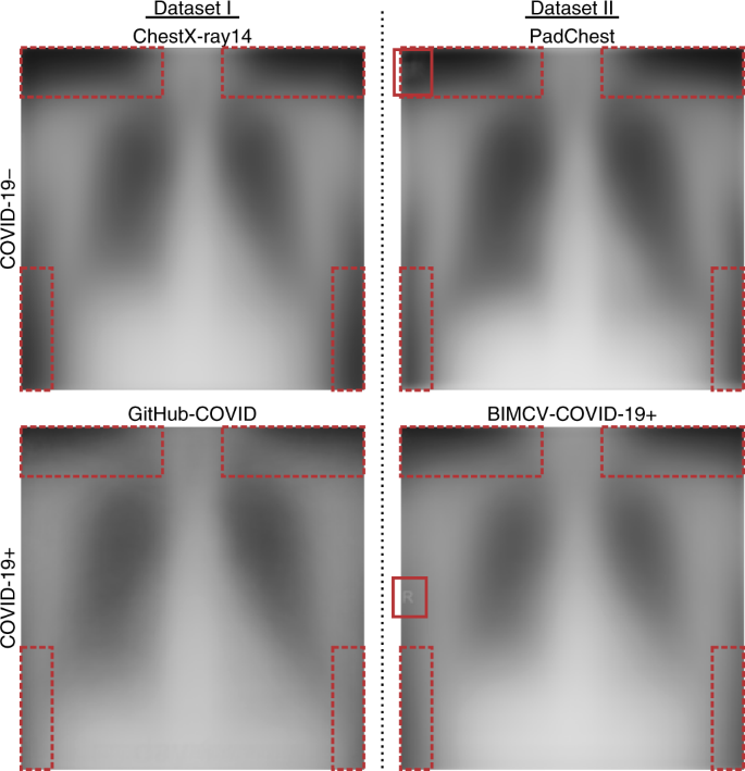 Average chest radiographs from four source repositories. Red boxes mark systematic differences in laterality markers and image-border intensity that could identify the repository rather than COVID-19 pathology.